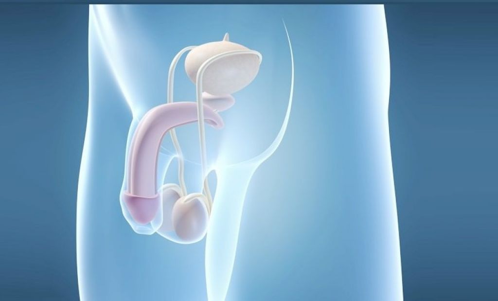 A implantação de prótese é um método cirúrgico para aumentar o pênis masculino